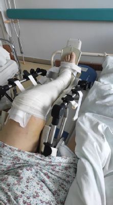 Nemocnica Levice má k dispozícii moderný spôsob pooperačnej liečby kĺbov Motodlahy pomáhajú 100 pacientom ročne